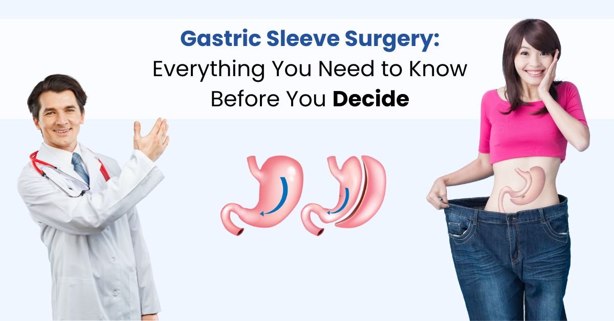Gastric Sleeve Surgery | Everything You Need to Know Before You Decide